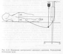 Monitorizarea practică a hemodinamicii în șoc, ghidul medicului