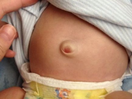 Copilul are o durere de stomac în zona ombilicului ce să facă