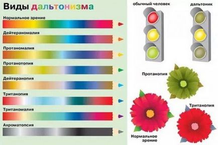 Tipuri de orbire color, semne, modul în care este moștenit și tratat