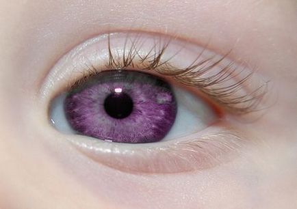 Чи можливий фіолетовий колір очей у людини фото людей з такими очима