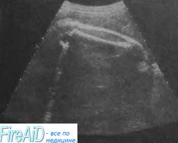 Caracteristicile ratelor de creștere a fătului cu scanarea cu ultrasunete (uzi) a femeilor însărcinate
