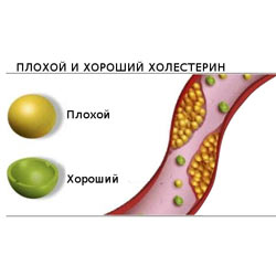 Холестерин поганий і хороший їх співвідношення і норма