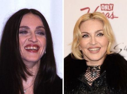 Dintii de celebritati de la Hollywood inainte si dupa o vizita la dentist, umkra