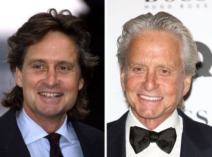 Fogak hollywoodi híresség utazás előtt és után a fogorvos, umkra (Celebrity fogak előtt és után) Fogak hollywoodi híresség utazás előtt és után a fogorvos, umkra