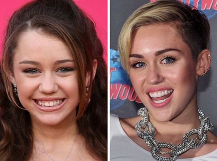 Dansuri celebritate Hollywood înainte și după o vizită la dentist, umkra