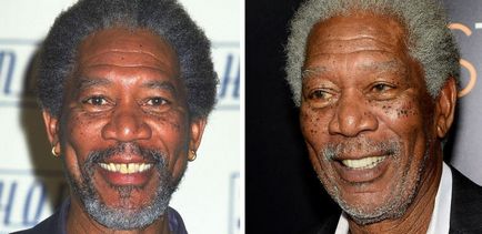 Зуби голлівудських знаменитостей до і після відвідин стоматолога, умкра