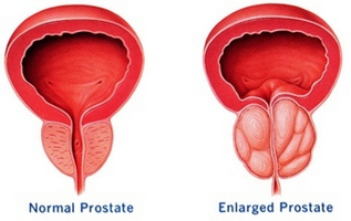 8 Sfaturi pentru prepararea prostatei și a vezicii urinare