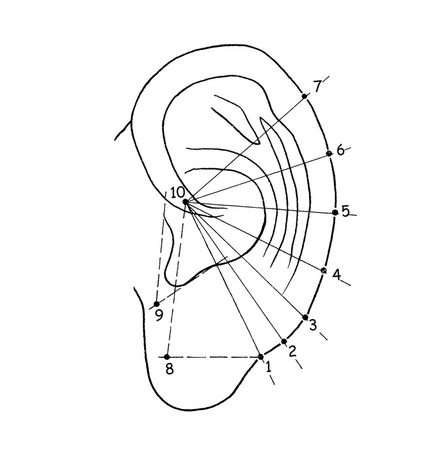 Acupunctura de la fumat