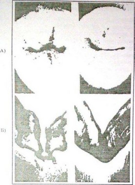 Caracteristici anatomico-morfologice, histologice și roentgenologice ale structurii temporare și