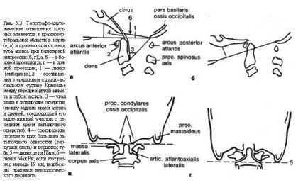 Rendellenességek craniovertebral