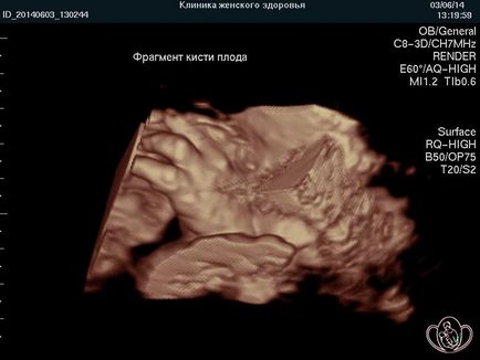 Terhesség hétről hétre, a klinika irányítását terhesség Pyatigorsk