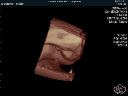Terhesség hétről hétre, a klinika irányítását terhesség Pyatigorsk