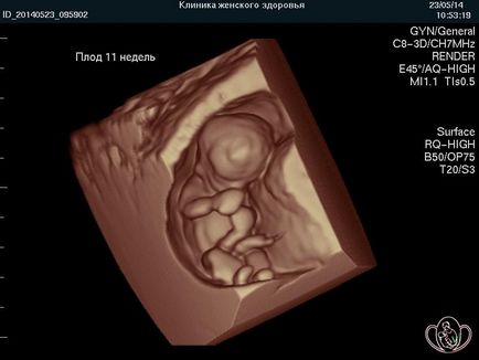Вагітність по тижнях, клініка ведення вагітності в П'ятигорську