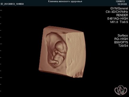 Вагітність по тижнях, клініка ведення вагітності в П'ятигорську