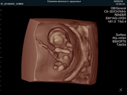Вагітність по тижнях, клініка ведення вагітності в П'ятигорську