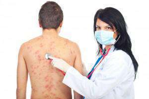 Череда від алергії рецепт приготування, лікування і протипоказання