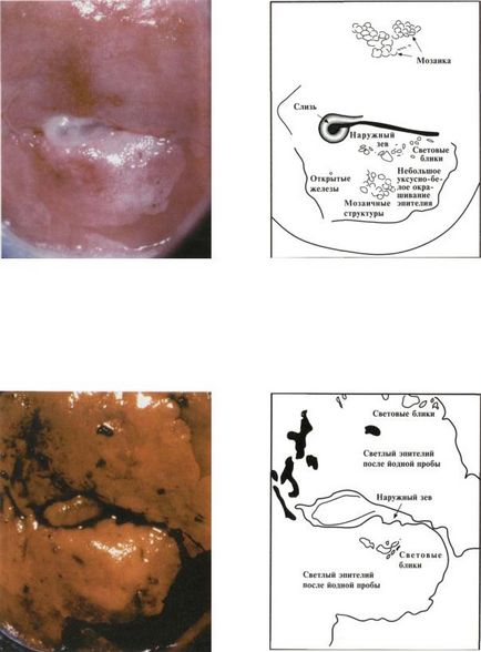 Atlasul citologic citologic pentru diagnosticarea bolilor de col uterin (shabalov)