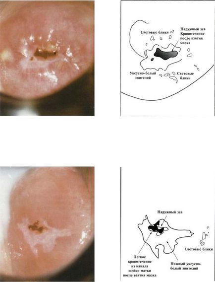 Atlasul citologic citologic pentru diagnosticarea bolilor de col uterin (shabalov)