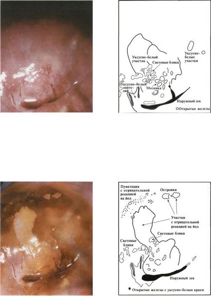 Atlasul citologic citologic pentru diagnosticarea bolilor de col uterin (shabalov)