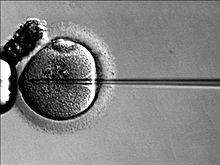 Fertilizarea in vitro