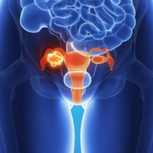 Tipul de endometrioză, gradul, tratamentul endometriozelor și sarcina în endometrioză