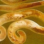 Gnathostomiasis fonálféreg tünetek emberben, hogy ez, kép (fotó) Gnathostomiasis fonálféreg tünetek emberben, hogy ez, fotók
