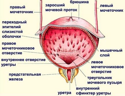 Інстиляція сечового міхура коларголом, протарголом і димексидом