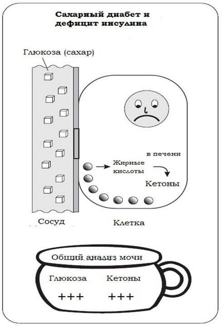 Insulina și importanța acestui hormon pentru organism