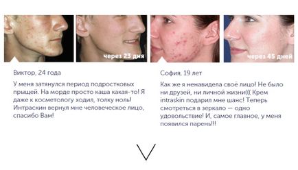 Intraskin krém akne