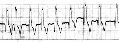 Schimbările în curba ecg pentru anumite tipuri de cardiopatologie la câini de diferite rase, cardiologie,