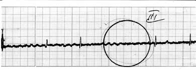 Változások EKG bizonyos típusú kardiopatology kutyák különböző fajták, kardiológia,