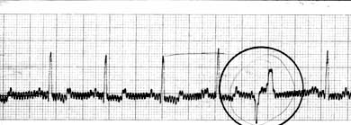 Schimbările în curba ecg pentru anumite tipuri de cardiopatologie la câini de diferite rase, cardiologie,