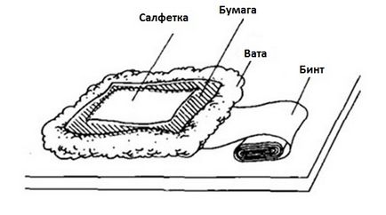 Які компреси застосовувати при ларингіті для дорослих зігріваючі, спиртові