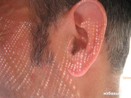 Як позбутися від сверблячки в вухах
