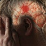 Hogyan lehet megelőzni az agyi stroke-