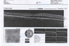 Consultarea oftalmologilor în kkb policlinică numărul 1 ochapovskogo