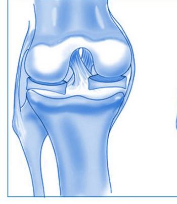 Răsucirea ligamentului articulației genunchiului, ruptura, ruperea, întinderea și modificările degenerative