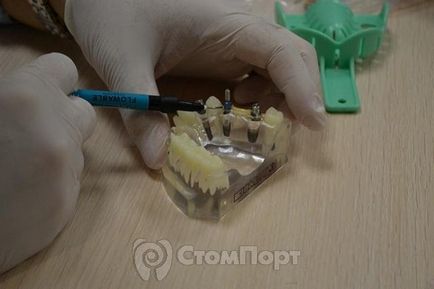 Курс по імплантації зубів