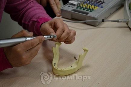 A kurzus a fogászati ​​implantátumok