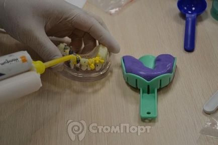 A kurzus a fogászati ​​implantátumok