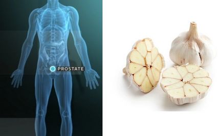 Tratamentul prostatitei cu usturoi - cum să mâncați rădăcină cu prostatită - rețete de la fitoterapeut