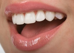 Tratamentul dinților în lublino și marino (terapie)