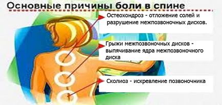 Masajul coloanei vertebrale lombare cu dureri de spate