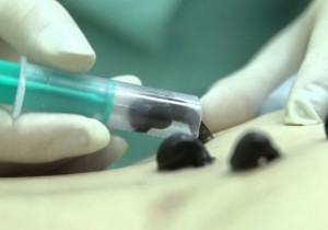 Метод «оксамитового голодування» доктора Альфреда Зіганшина очищення організму за 3 тижні