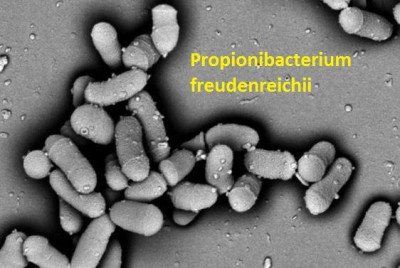 Microbiologia brânzeturilor