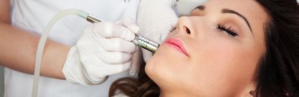 Este posibil să se efectueze diferite tipuri de peeling după injecțiile cu Botox