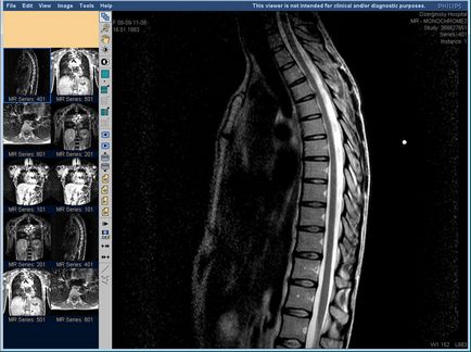 MRI A gerincvelő az árak a Moszkva, vaszkuláris MRI a nyaki gerinc