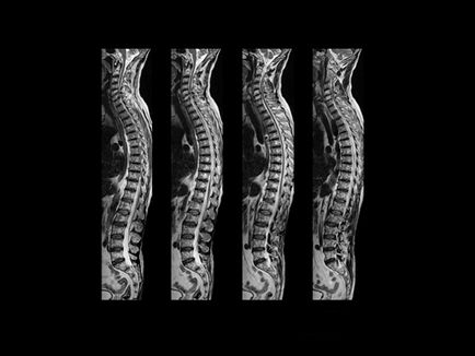 MRI A gerincvelő az árak a Moszkva, vaszkuláris MRI a nyaki gerinc