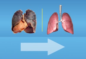 Curățarea plămânilor după renunțarea la fumat