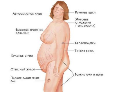 Пухлини наднирників симптоми у жінок і чоловіків, лікування операція оп видалення